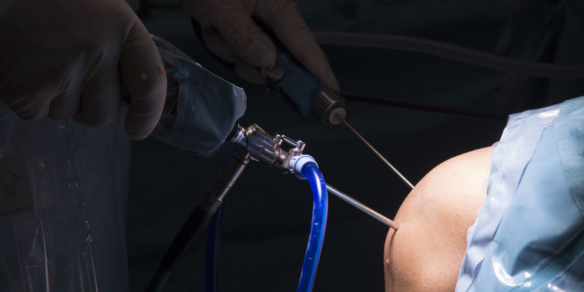 Αρθροσκόπηση Γόνατος